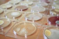 Микробиологические экспресс тесты